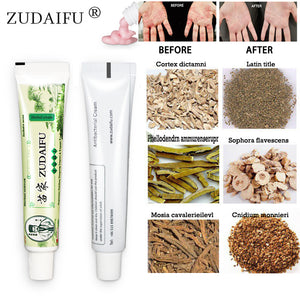 100% Original zudaifu Skin Psoriasis Cream